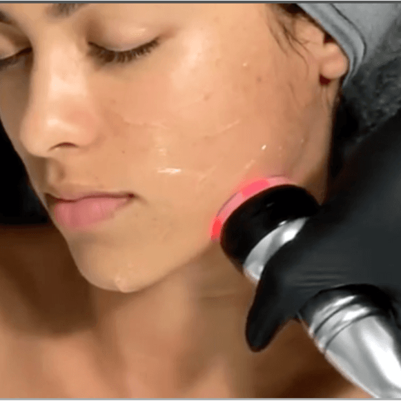 Tone & Sculpt Facial- 18 Treatments at Eight31 Esthetics in Livingston, TX