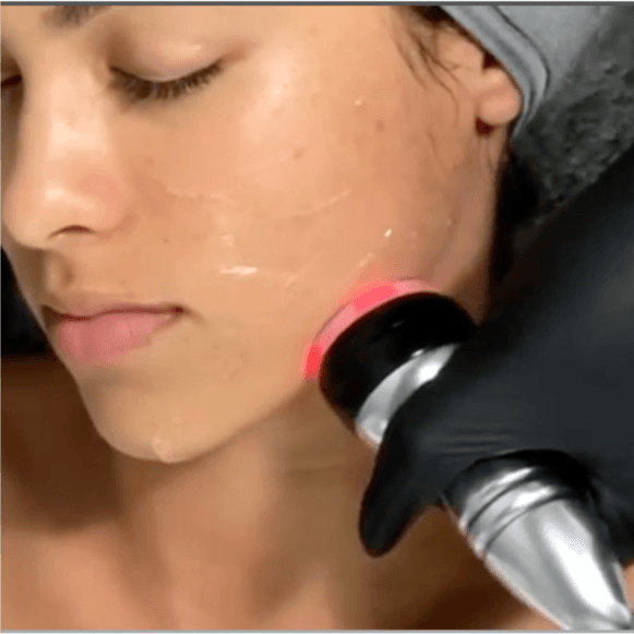 Tone & Sculpt Facial- 12 Treatments at Eight31 Esthetics in Livingston, TX
